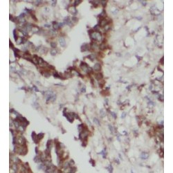 Prostaglandin G/H Synthase 2 / COX-2 (PTGS2) Antibody