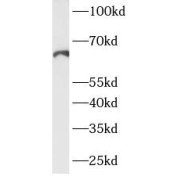 WB analysis of LPS treated HeLa cells, using COX2 antibody (1/1000 dilution).