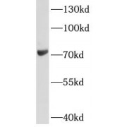 WB analysis of A549 cells, using LOXL1 antibody (1/1000 dilution).