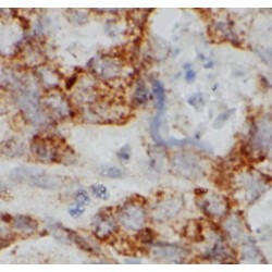 Anti-Rh Blood Group, D Antigen Antibody (Anti-RHD) Antibody