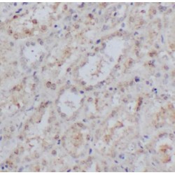 Galanin (GAL) Antibody