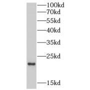 WB analysis of A549 cells, using EREG antibody (1/1000 dilution).