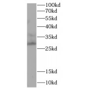 WB analysis of rat testis, using ABC3A antibody (1/1000 dilution).