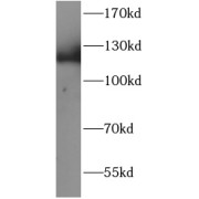 WB analysis of A549 cells, using EML4 antibody (1/1000 dilution).