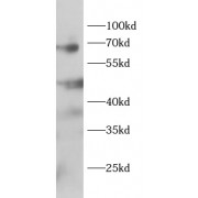 WB analysis of rat brain, using TRAF5 antibody (1/1000 dilution).