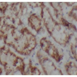 Purinergic Receptor P2X 4 (P2RX4) Antibody