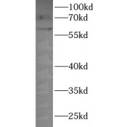 WB analysis of MCF-7 cells, using P2RX4 antibody (1/1000 dilution).