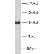 WB analysis of A547 cells, using PCDH15 antibody (1/1000 dilution).