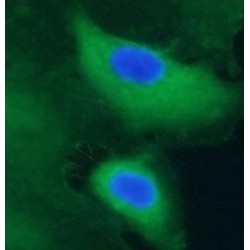 Gastric Intrinsic Factor (GIF) Antibody