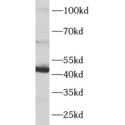 WB analysis of Mouse heart, using GIF antibody (1/1000 dilution).