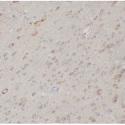 IHC-P analysis of Rat brain tissue, using PSPB antibody (1/200 dilution).