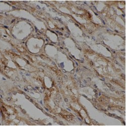 Cytoglobin (CYGB) Antibody