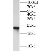 WB analysis of Mouse heart tissue, using cygb antibody (1/1000 dilution).