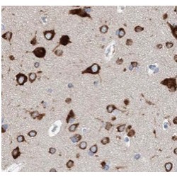 Serotonin Transporter (SERT) Antibody