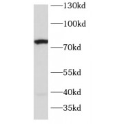 WB analysis of Rat brain tissue, using Serotonin Transporter Antibody (1/1000 dilution).