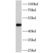 WB analysis of HepG2 cells, using FADS2 antibody (1/1000 dilution).