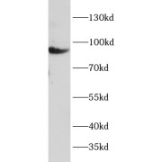 WB analysis of MCF7 cells, using KS6A1 antibody (1/1000 dilution).