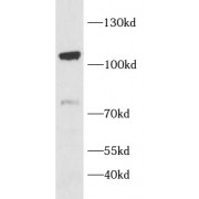 WB analysis of HeLa cells, using SIK2 antibody (1/1000 dilution).