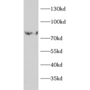 WB analysis of HepG2 cells, using VNN1 antibody (1/1000 dilution).