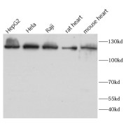 WB analysis of various lysates, using ATP citrate lyase antibody (1/1000 dilution).