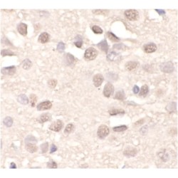 Aprataxin (APTX) Antibody