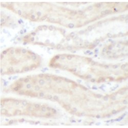 Frizzled Homolog 4 (FZD4) Antibody