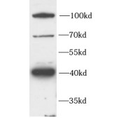 WB analysis of K562 cells, using FZD4 antibody (1/1000 dilution).