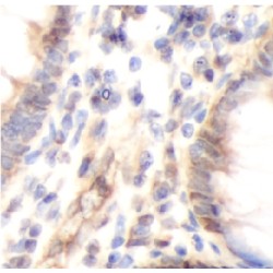 Probable fructose-2,6-bisphosphatase TIGAR (TIGAR) Antibody