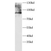WB analysis of mouse spleen tissue, using VAV3 antibody (1/800 dilution).