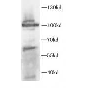 WB analysis of HEK293 cells, using CHM antibody (1/500 dilution).
