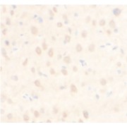 IHC-P analysis of rat brain tissue, using ARPC5L antibody (1/100 dilution).