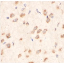 Metadherin (MTDH) Antibody