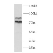 WB analysis of MCF7 cells, using AEG-1 antibody (1/1000 dilution).