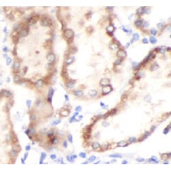 Carnitine O-Acetyltransferase (CRAT) Antibody