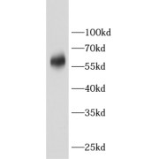 WB analysis of mouse heart tissue, using CRAT antibody (1/1000 dilution).