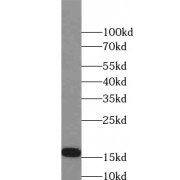 WB analysis of mouse liver tissue, using HCRT antibody (1/1000 dilution).
