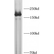 WB analysis of U-87MG cells, using SASH1 antibody (1/1000 dilution).