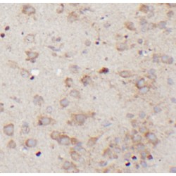 Nestin (NES) Antibody