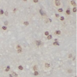 High Mobility Group Protein B1 (HMGB1) Antibody