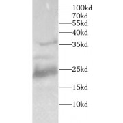 WB analysis of MCF7 cells, using HMGB1 antibody (1/1000 dilution).