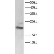 WB analysis of A549 cell lysates, using ICT1 antibody (1/1000 dilution).