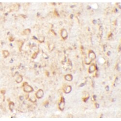 Zinc Finger Protein 140 (ZNF140) Antibody