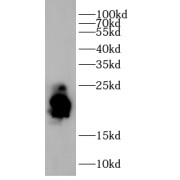 WB analysis of Raji cell lysates, using CD3E antibody (1/1000 dilution).