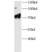 WB analysis of A431 cell lysates, using FLCN antibody (1/1000 dilution).