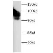 WB analysis of mouse spleen lysates, using CD105 antibody (1/1000 dilution).