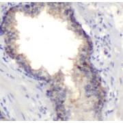 IHC-P analysis of human prostate tissue, using FURIN antibody (1/100 dilution).