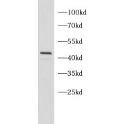 WB analysis of HeLa cell lysates, using TSG101 antibody (1/5000 dilution).