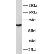 WB analysis of A549 cells, using METTL14 antibody (1/1000 dilution).