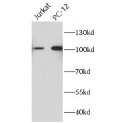 WB analysis of various lysates, using CIP2A antibody (1/5000 dilution).