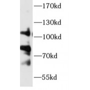 WB analysis of mouse uterus tissue, using CLCA1 antibody (1/1000 dilution).